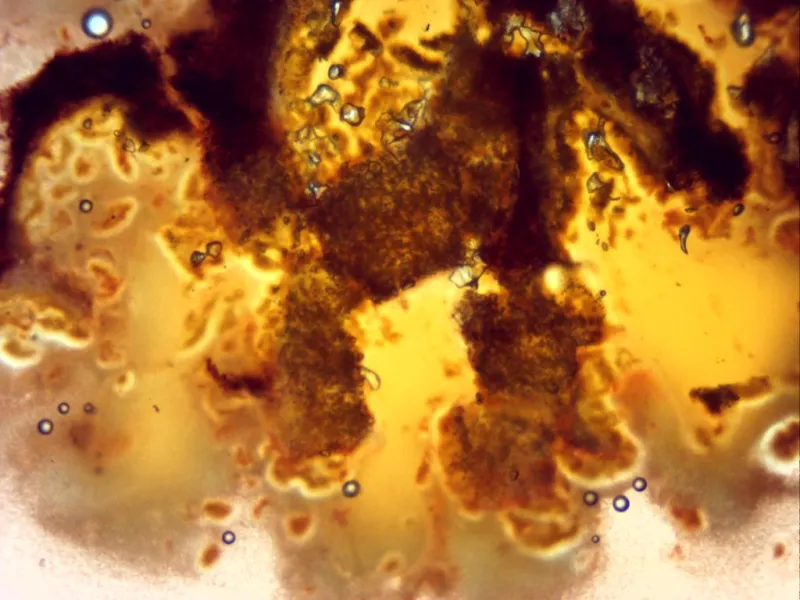 Cytospora chrysosperma 26 - Base a 40 aumentos